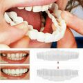 Kosmetische Zahnprothese Prothese Zahnersatz Falsche Zähne Set Gebiss Reparatur;