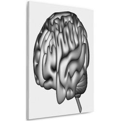 Wallario Leinwandbild, Menschliches Gehirn in Schwarz-Weiß
